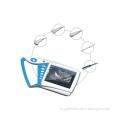 Aj-6100p/ Full Digital Palm Ultrasound Scannerwith Built-in Li-Battery